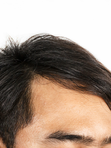 Uzupełnianie włosów dla mężczyzn