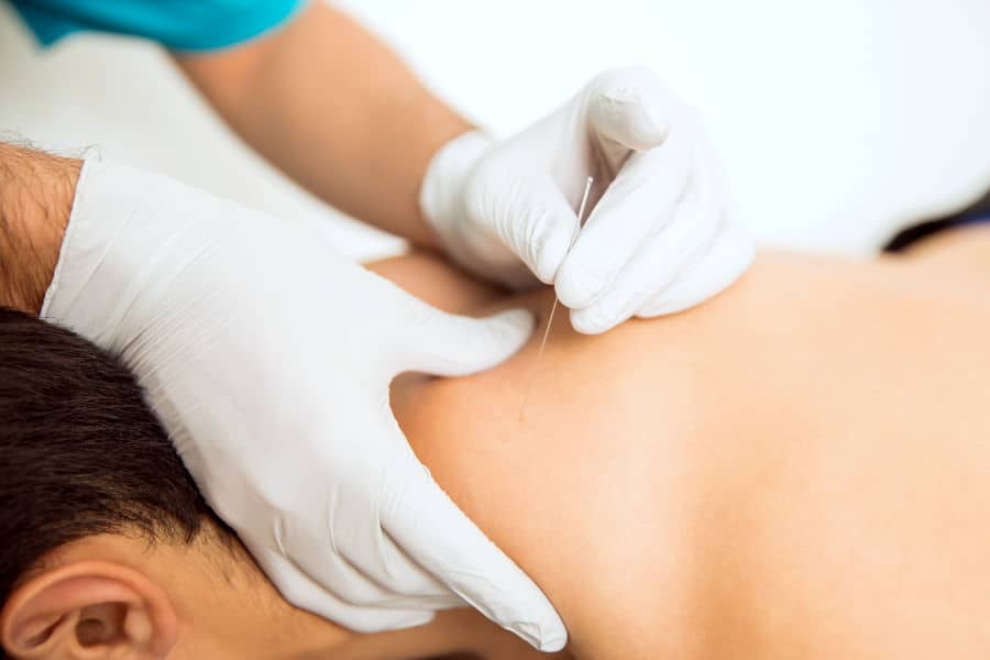 Dry Needling tehnika učinkovita je kod liječenja miofascijalne boli - Fitrehabhr